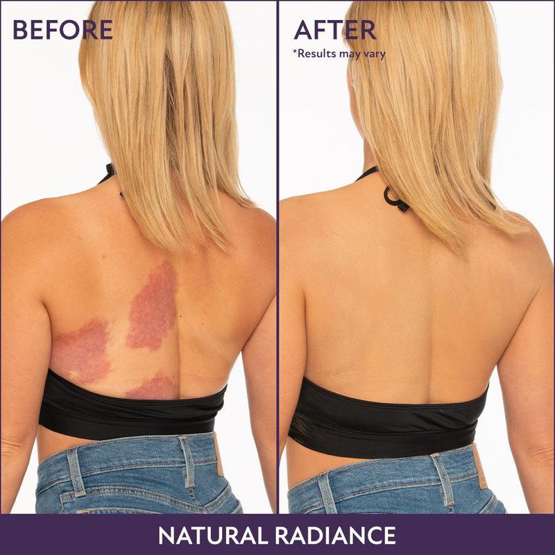 🔥LAST DAY SALE 49% OFF!✨Body Coverage Perfector – Waterproof, lightweight & flawless body makeup
