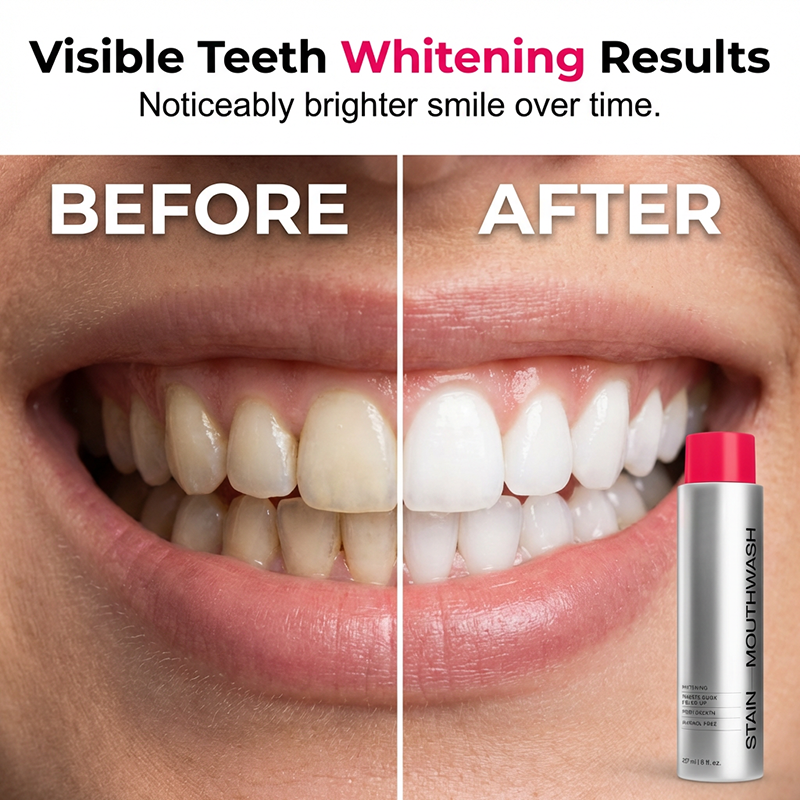 🔥BUY 2 GET 1 FREE✨  Stain‑Removing Whitening Mouthwash – Lifts coffee & tea stains, alcohol‑free🦷💙